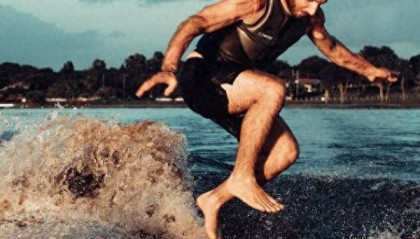 1.4万伏特电击不死，他70次手术后重生